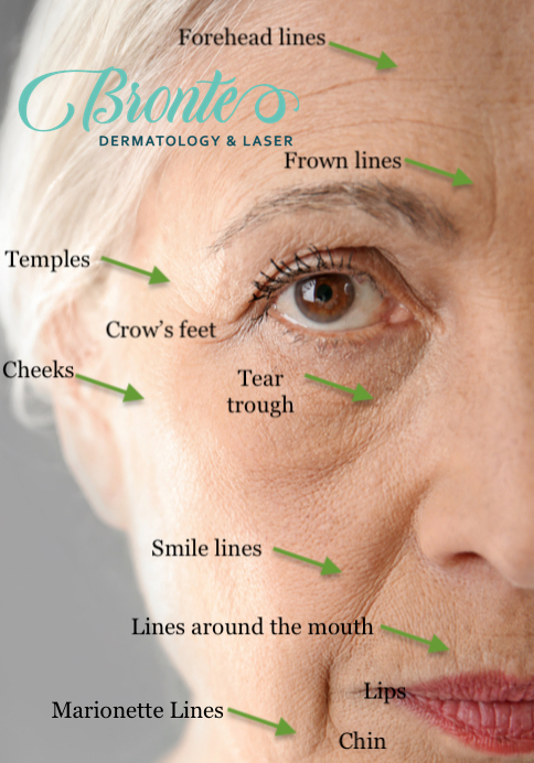 Treatable areas of the face